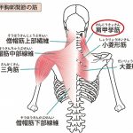 肩甲挙筋のシール鍼で肩こりが激減の詳細へ